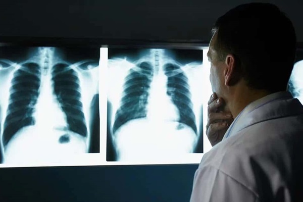 Pesquisa aponta danos ao DNA causados por Raios-X em doses consideradas seguras